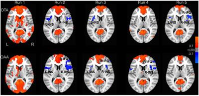 Effect of Continuous Touch on Brain Functional Connectivity Is Modified by the Operator’s Tactile Attention